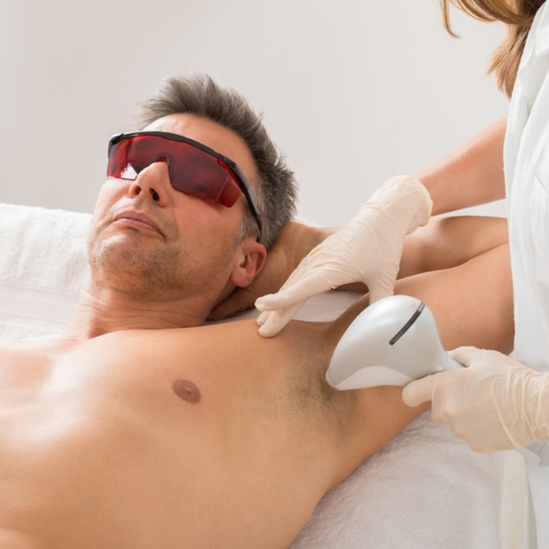 Laser Hair Removal for Men - Skingen Pakistan