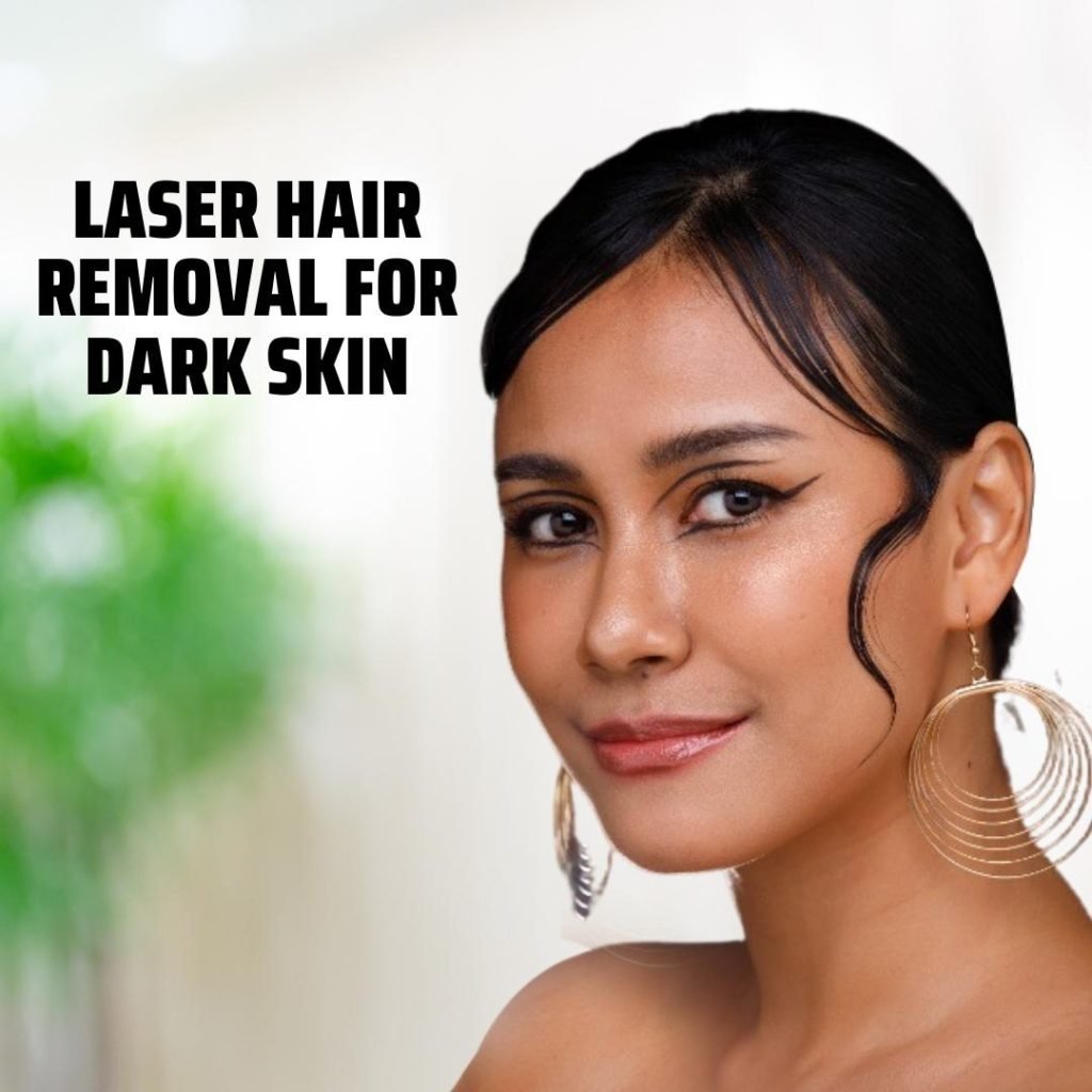 Laser Hair Removal for Dark Skin - Skingen Pakistan