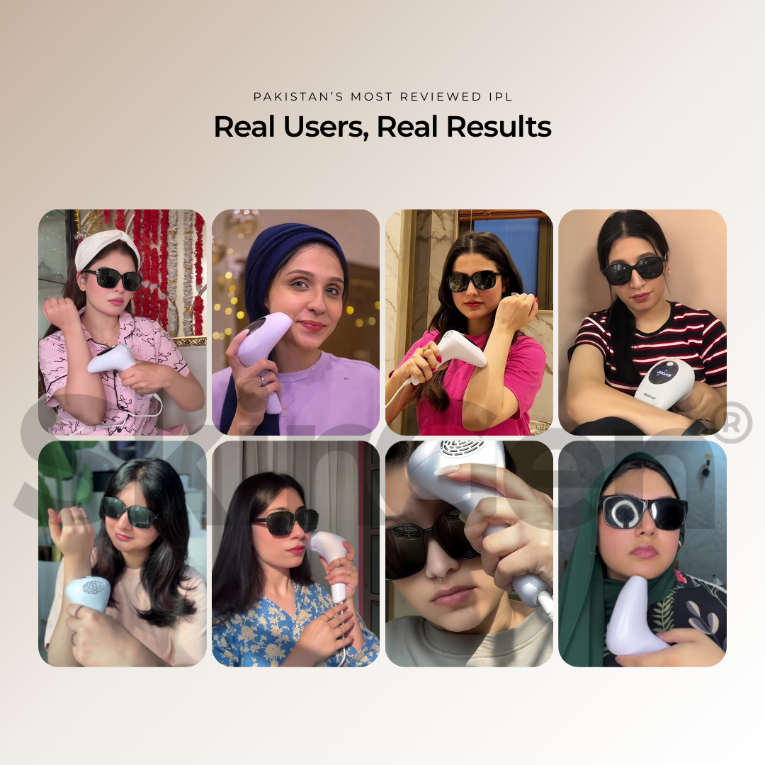 SkinGen Classic IPL Laser Device