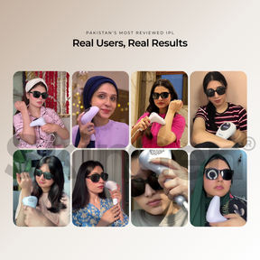 SkinGen Classic IPL Laser Device