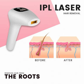 SkinGen IPL Hair Laser Removal Device
